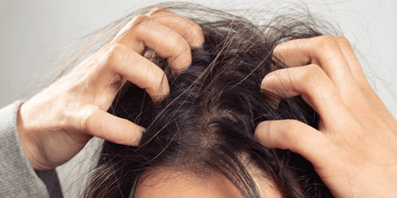 Reasons Your Scalp Itches And How To Get Rid Of It